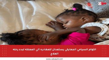 التوأم السيامي الجمايكي يستعدان للمغادرة إلى المملكة لبدء رحلة العلاج